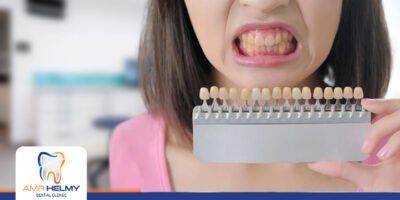 اسباب اصفرار الاسنان وكيفية علاجها